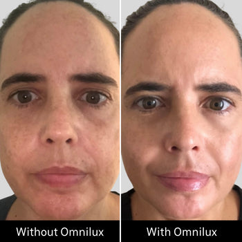 Omnilux Contour Face - The Luxe Medspa