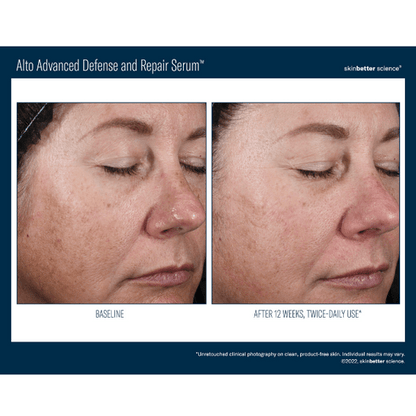 Alto Advanced Defense and Repair Serum Travel Size SkinBetter Science - The Luxe Medspa