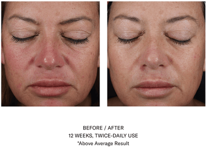 Mystro Active Balance Serum Travel Size SkinBetter Science - The Luxe Medspa