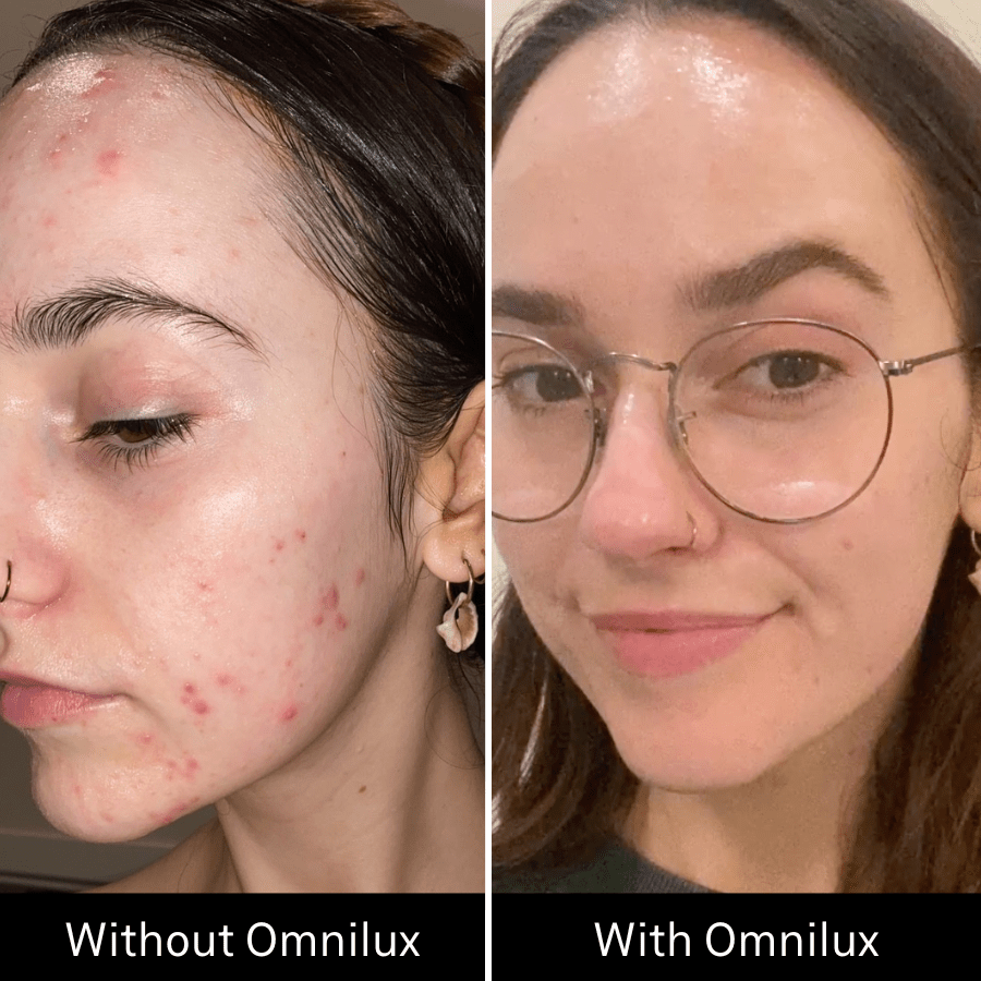 Omnilux Clear Omnilux - The Luxe Medspa