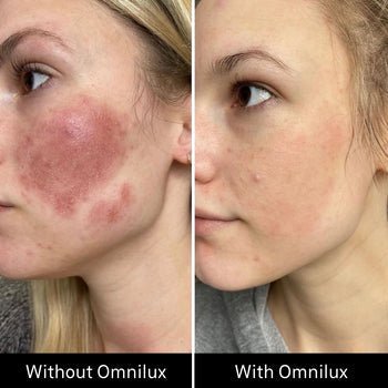 Omnilux Contour Face Omnilux - The Luxe Medspa