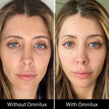 Omnilux Contour Face Omnilux - The Luxe Medspa