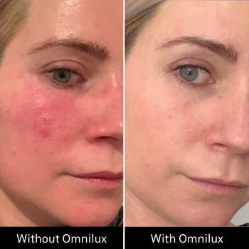 Omnilux Contour Face Omnilux - The Luxe Medspa