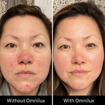 Omnilux Contour Face Omnilux - The Luxe Medspa