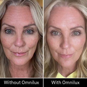 Omnilux Contour Face Omnilux - The Luxe Medspa