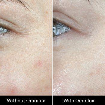 Omnilux Contour Face Omnilux - The Luxe Medspa