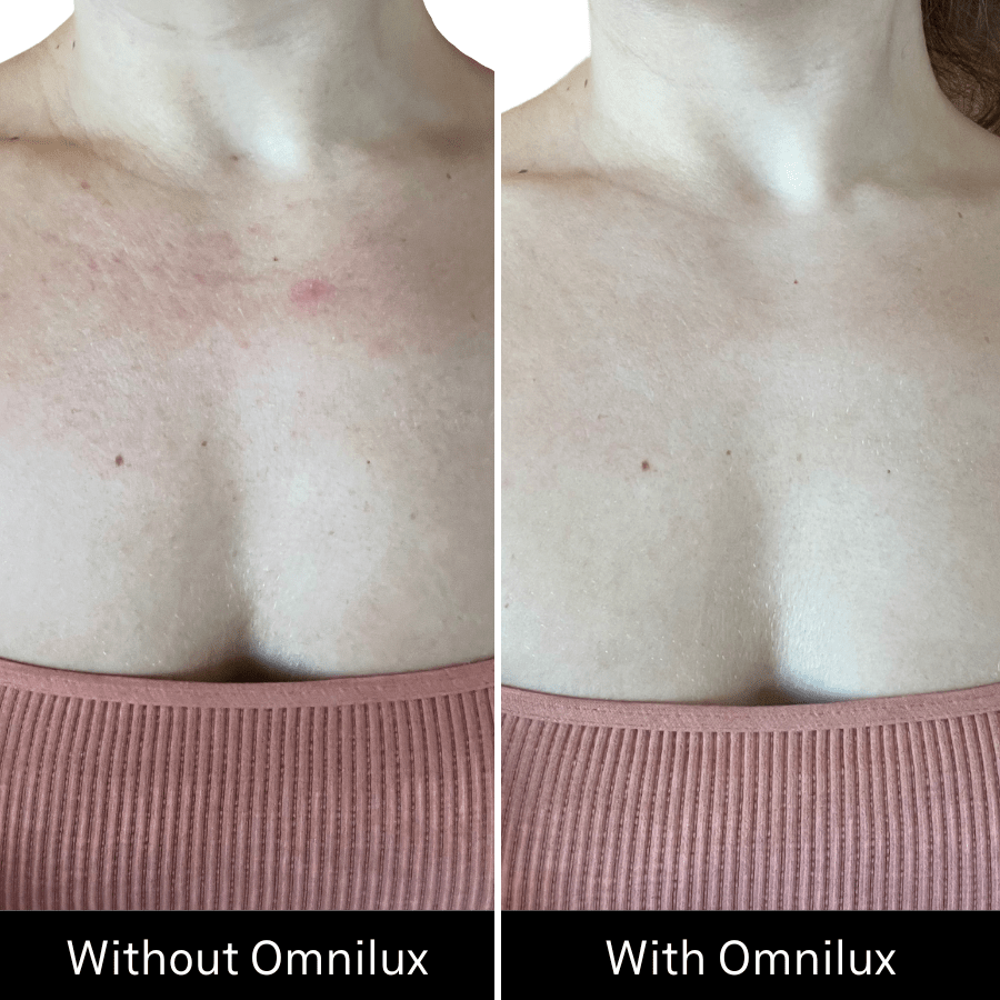 Omnilux Contour Neck & Décolleté Omnilux - The Luxe Medspa