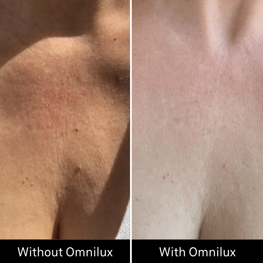 Omnilux Contour Neck & Décolleté Omnilux - The Luxe Medspa