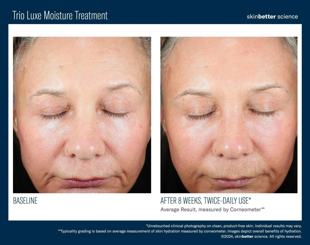 Trio Luxe Moisture Treatment Travel Size SkinBetter Science - The Luxe Medspa