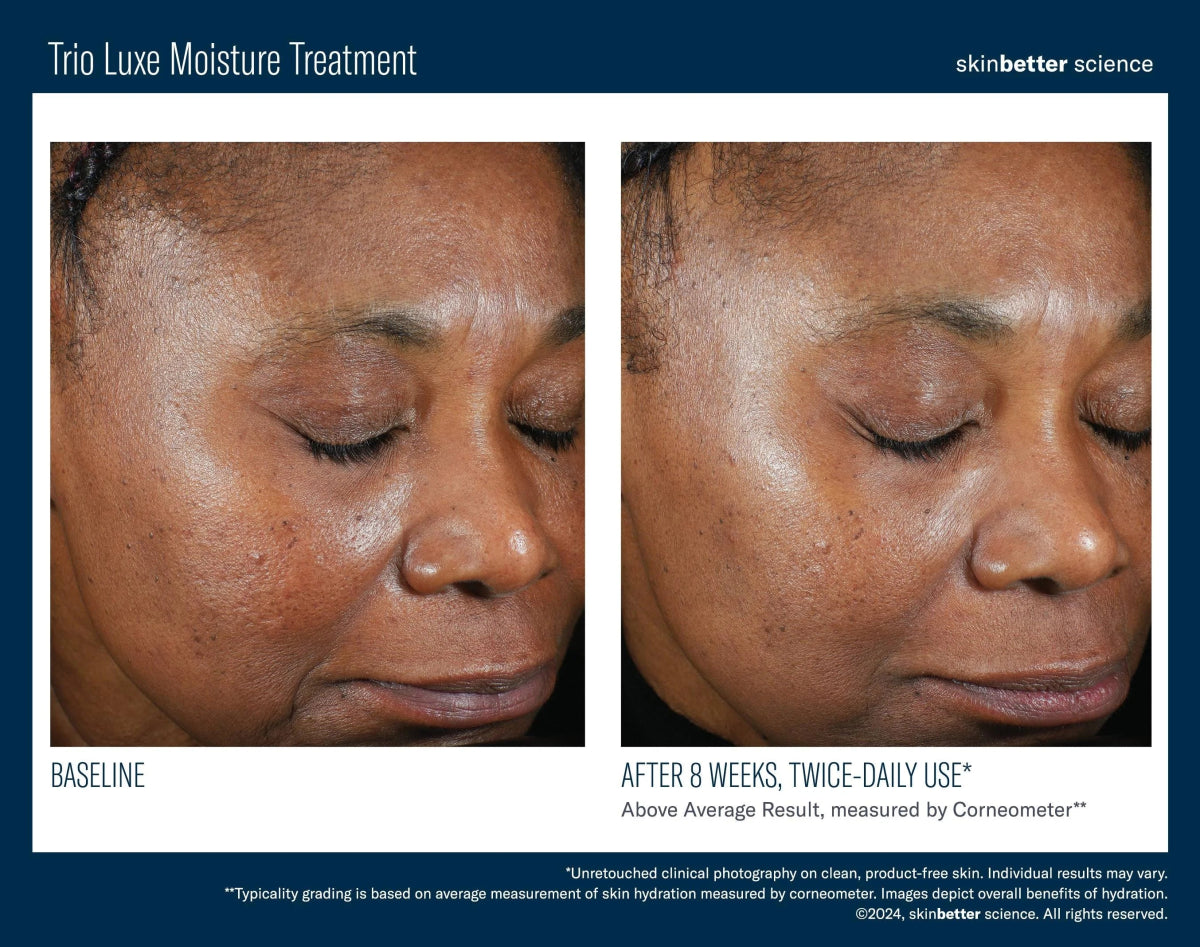 Trio Luxe Moisture Treatment Travel Size SkinBetter Science - The Luxe Medspa
