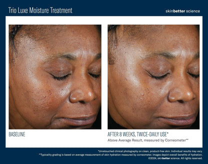 Trio Luxe Moisture Treatment Travel Size SkinBetter Science - The Luxe Medspa