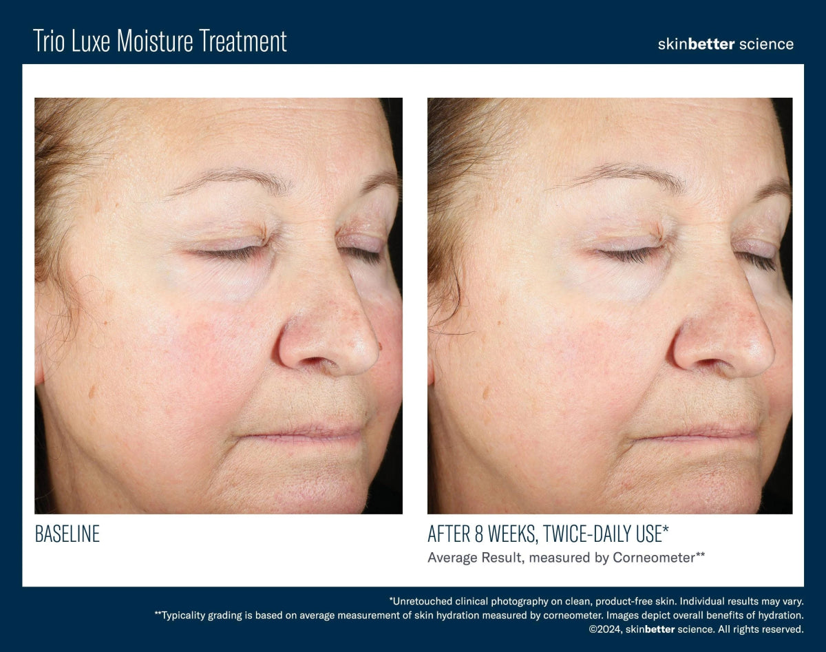 Trio Luxe Moisture Treatment Travel Size SkinBetter Science - The Luxe Medspa