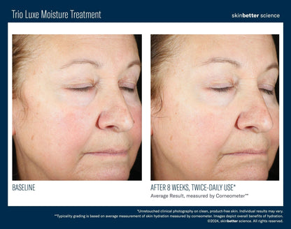 Trio Luxe Moisture Treatment Travel Size SkinBetter Science - The Luxe Medspa