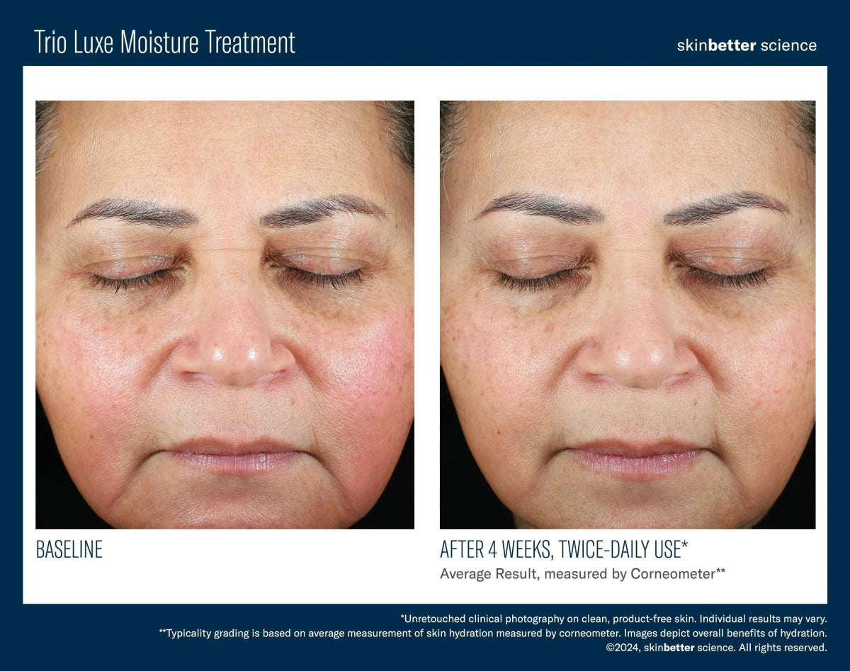Trio Luxe Moisture Treatment Travel Size SkinBetter Science - The Luxe Medspa