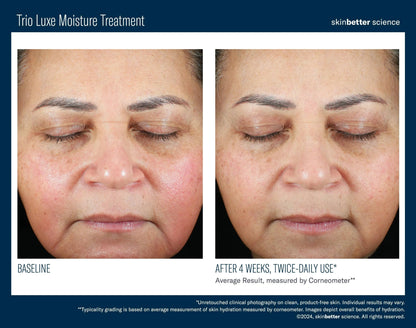 Trio Luxe Moisture Treatment Travel Size SkinBetter Science - The Luxe Medspa